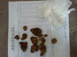 孩子五周岁多,吃饭一直不香,体重33斤,不爱吃水果蔬菜,大便干燥颗粒状,像羊屎 一直这样,不知啥毛病
