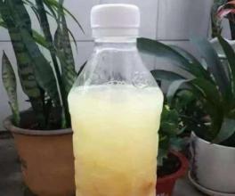 阳台种蔬菜,要想长得旺,施肥是关键,这 3招 太实用了 网易订阅