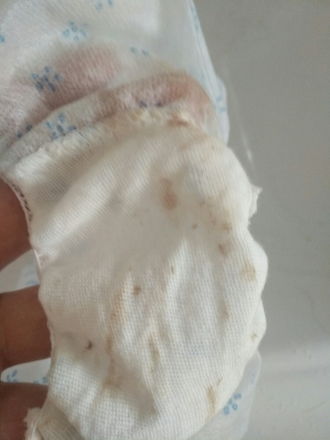 刚到预产期就流出褐色分泌物那是见红了吗