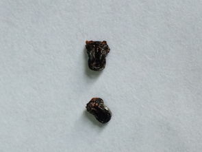 穿着衣服来到公司,发现衣服上有一堆这种,类似蛋壳一样的东西,不知是什么虫的卵,衣服一直挂在衣厨里的