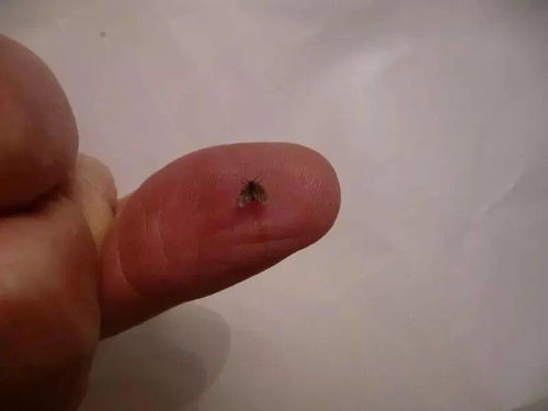 厨房厕所的 小飞虫 ,从哪儿来 该怎么消灭