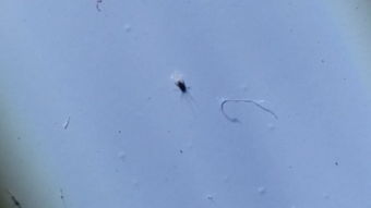 今天在家里突然发现这样的虫子有知道的告诉一下到底是什么东西,灰尘大小的虫子,肉眼可见