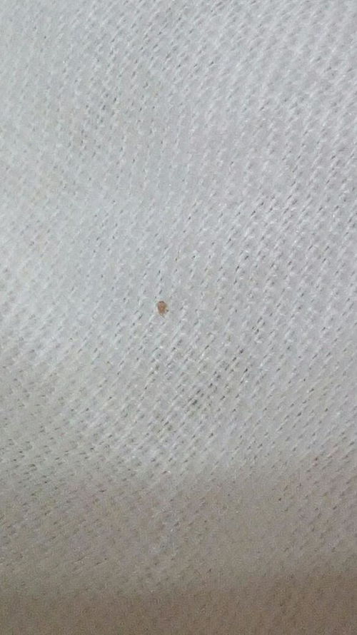 床上有很多小白虫子是什么虫呀 太可怕了,都不敢睡觉了 