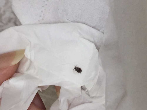 芝麻大的小黑虫