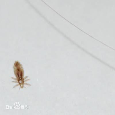 这是什么虫子 从头发上掉下来的